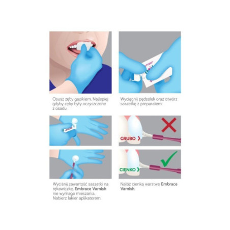 Embrance Varnish 5% Lakier do Fluoryzacji Remineralizujący szkliwo