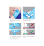 Embrance Varnish 5% Lakier do Fluoryzacji Remineralizujący szkliwo