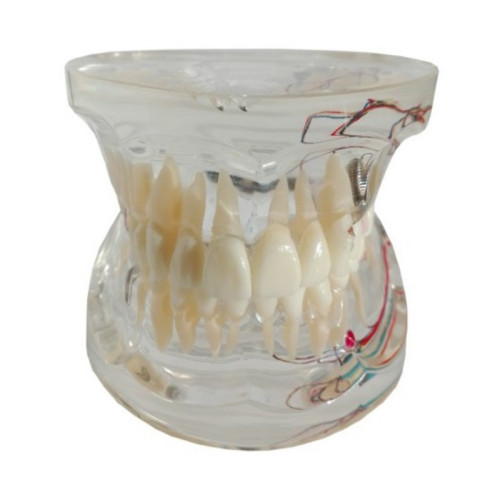 Model Zęby + Patologie, Unerwiene, Unaczynienie (M4019-2)