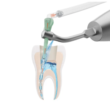 Pac-Dent iVac System do irygacji Intro Kit