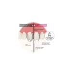 Unica Proximal Anterior DEEP 100 szt - 6952