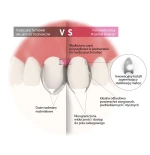 Unica Proximal Anterior 100 szt 6913