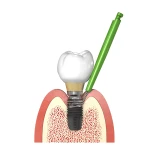 iBrush ( Opakowanie 10 sztuk )