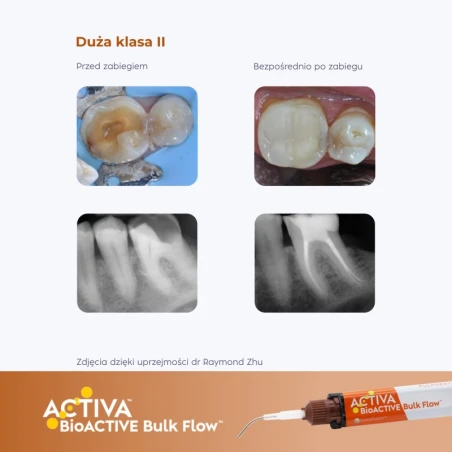 Activa Bioactive Bulk Flow KIDS - Universal