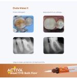 Activa Bioactive Bulk Flow KIDS - Universal