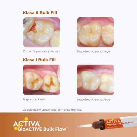 Activa Bioactive Bulk Flow KIDS - Universal