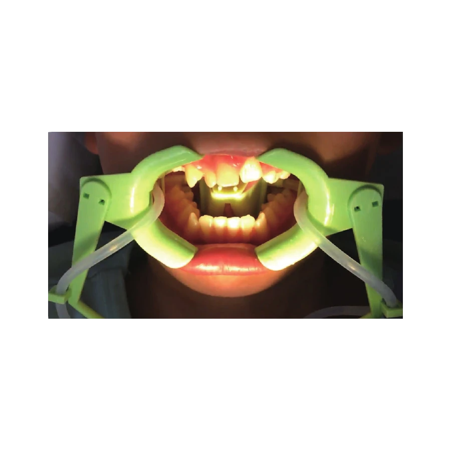 Rozwierak do policzków i ust z odsysaniem płynów