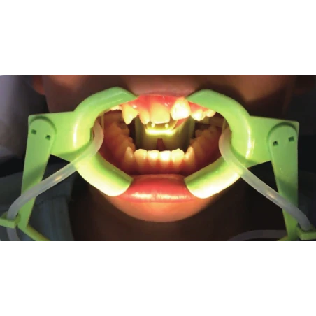 Rozwierak do policzków i ust z odsysaniem płynów