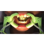 Rozwierak do policzków i ust z odsysaniem płynów