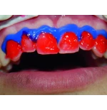 Notredam - Płynny Koferdam 2 x 5 g strzykawka