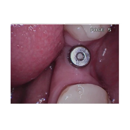 Kamera - AdvanceCAM HQ A