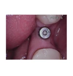 Kamera - AdvanceCAM HQ A