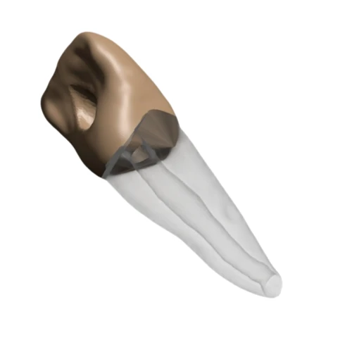 BIOMED 3D Tooth - Ząb Treningowy - Centralny siekacz 1,4 mm otwarty wierzchołek
