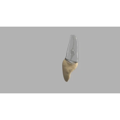 BIOMED 3D Tooth - Ząb treningowy - 9 z resorpcją