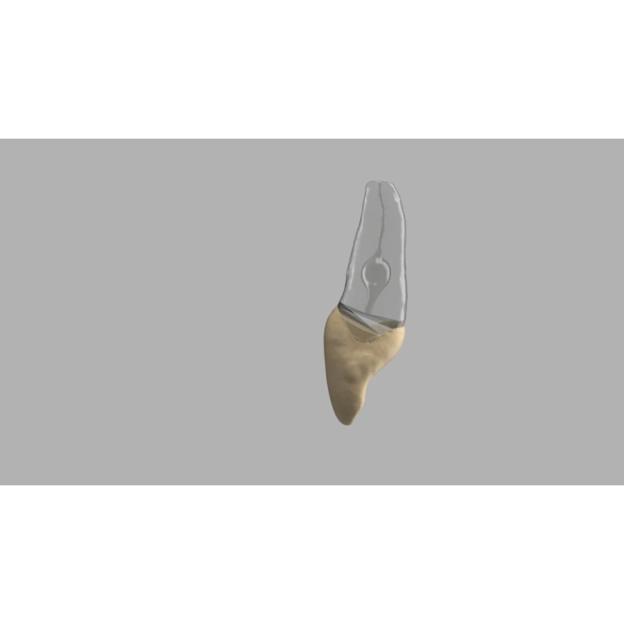 BIOMED 3D Tooth - Ząb treningowy - 9 z resorpcją