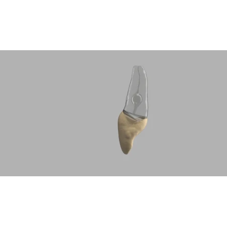 BIOMED 3D Tooth - Ząb treningowy - 9 z resorpcją