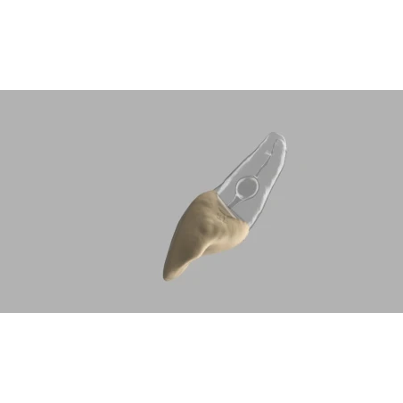 BIOMED 3D Tooth - Ząb treningowy - 9 z resorpcją
