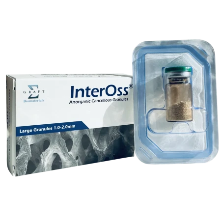 InterOss materiał kościozastępczy pochodzenia wołowego granulat gruby -1.0-2.0mm-1.0g