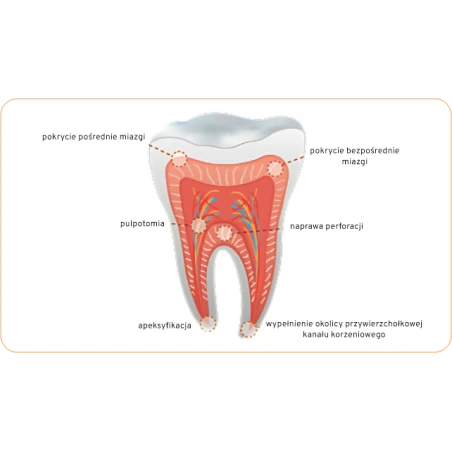 Endocem Premix MTA Maruchi
